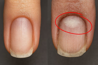 4 Mistakes That Leave Dirty Nail Sinuses – And How to Fix Them