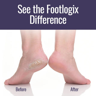 Footlogix Ultimate At-Home Foot Care Combo Footlogix 