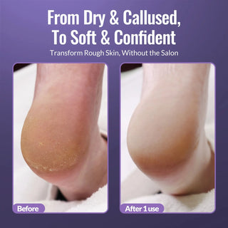 Footlogix Ultimate At-Home Foot Care Combo Footlogix 