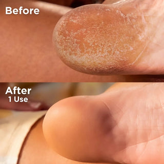 Footlogix At Home Double-Sided Foot File Footlogix 