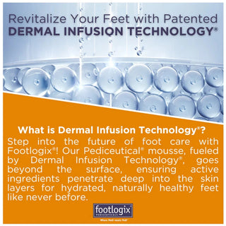 Footlogix Cold Feet Formula Mousse, 125 ml Footlogix 