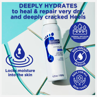 Footlogix Cracked Heel Formula Mousse, 125 ml Footlogix 