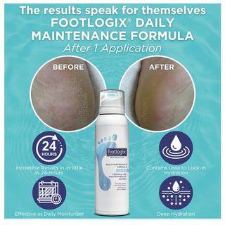 Footlogix Daily Maintenance Formula Mousse, 125 ml Footlogix 