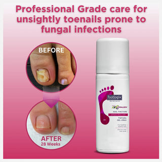 Footlogix Nail Tincture Spray, 50 ml Footlogix 