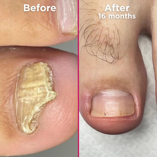 Footlogix Nail Tincture Spray, 50 ml Footlogix 