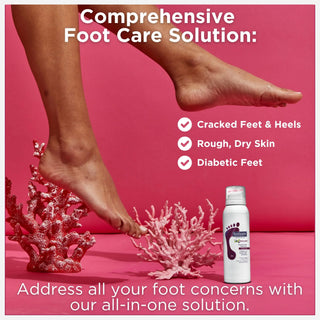 Footlogix Rough Skin Formula Mousse, 125 ml Footlogix 