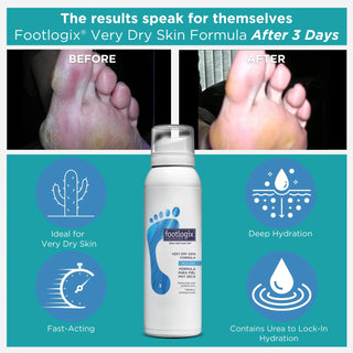 Footlogix Very Dry Skin Formula Mousse, 125 ml Footlogix 