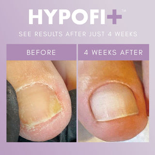 TGB HypoFix™ Primer, 20 ml THE GELBOTTLE 
