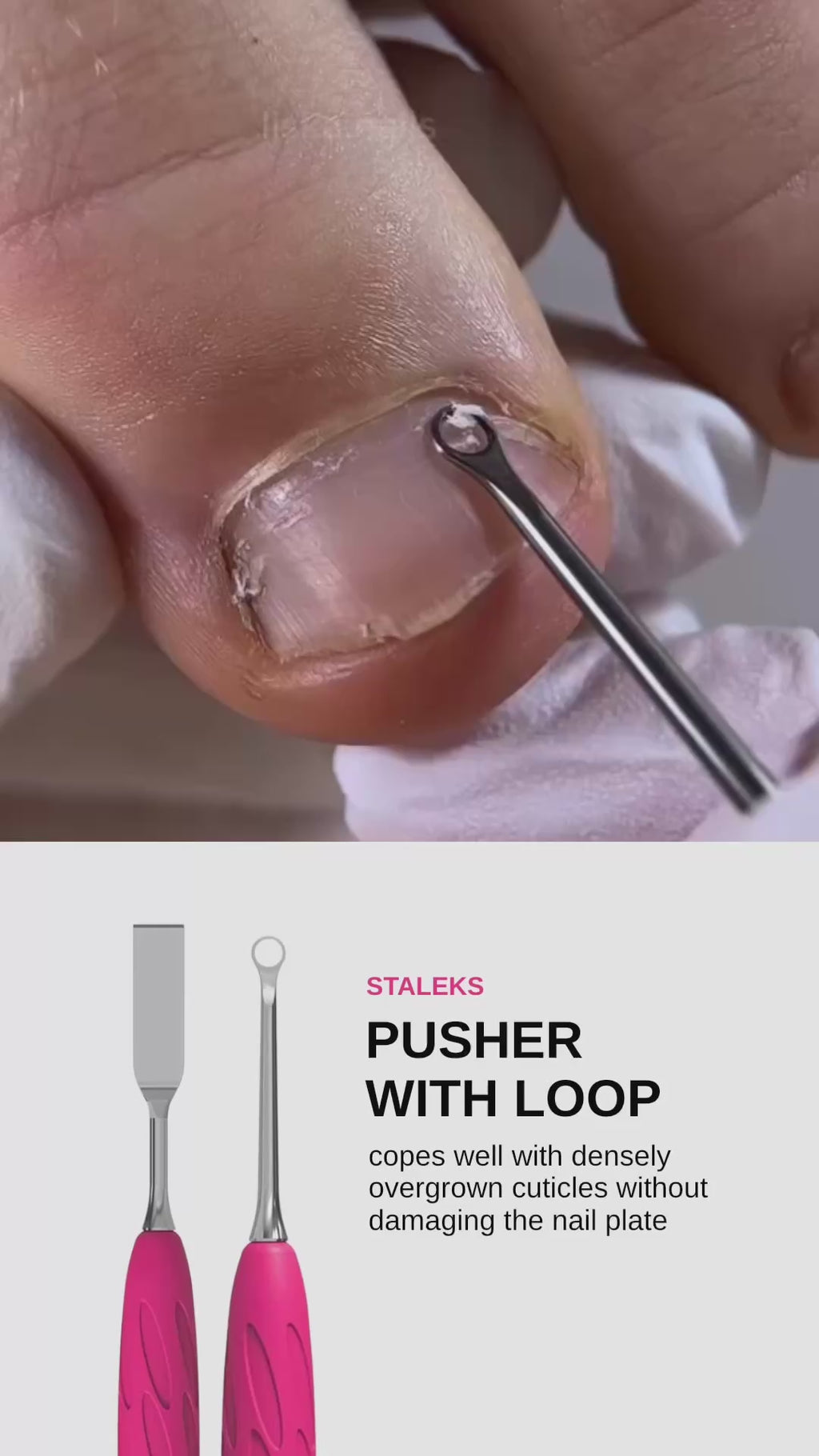 Staleks Manicure pusher with silicone handle “Gummy” UNIQ 11 TYPE 1 (flat straight pusher + loop) Cuticle Pusher Staleks